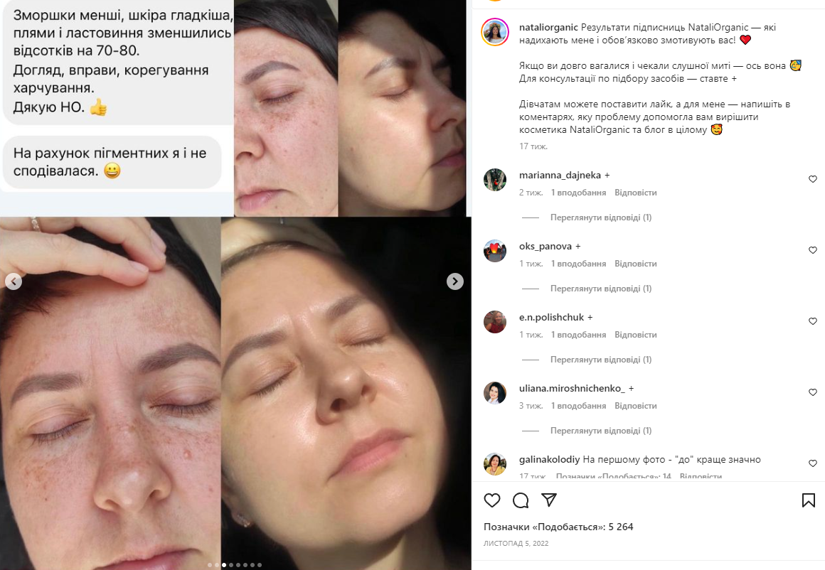 Приклад рекламного поста в Інстаграмі у форматі «до й після»